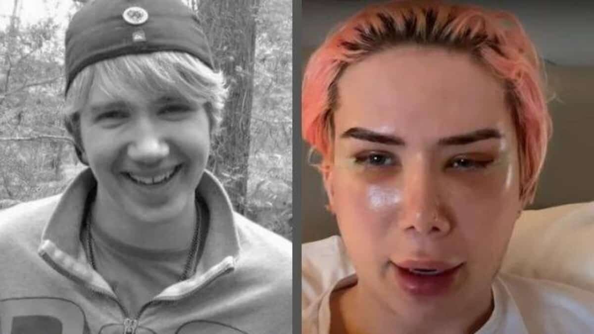 Inlfuencer se declara transracial y se opera para parecerse a Jimin de BTS
