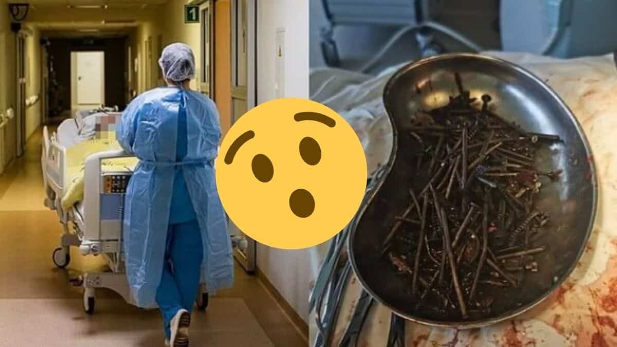Médicos extraen clavos y tornillos del estómago de un hombre