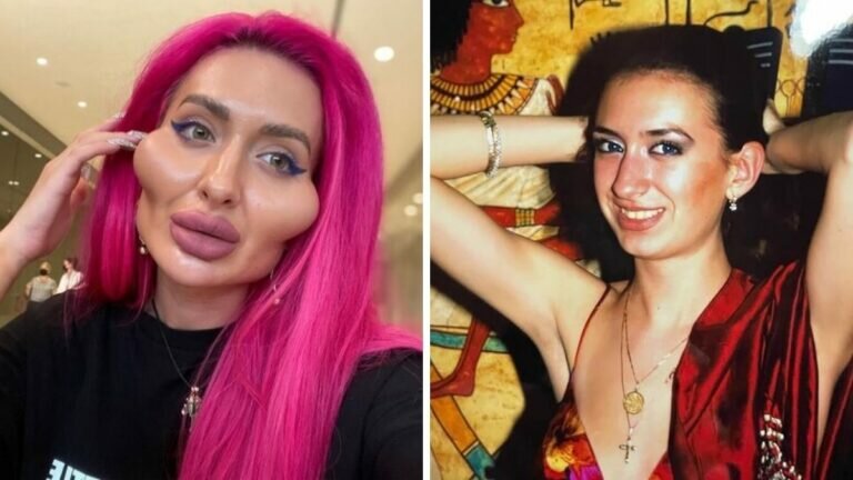 Mujer con los pómulos más prominentes