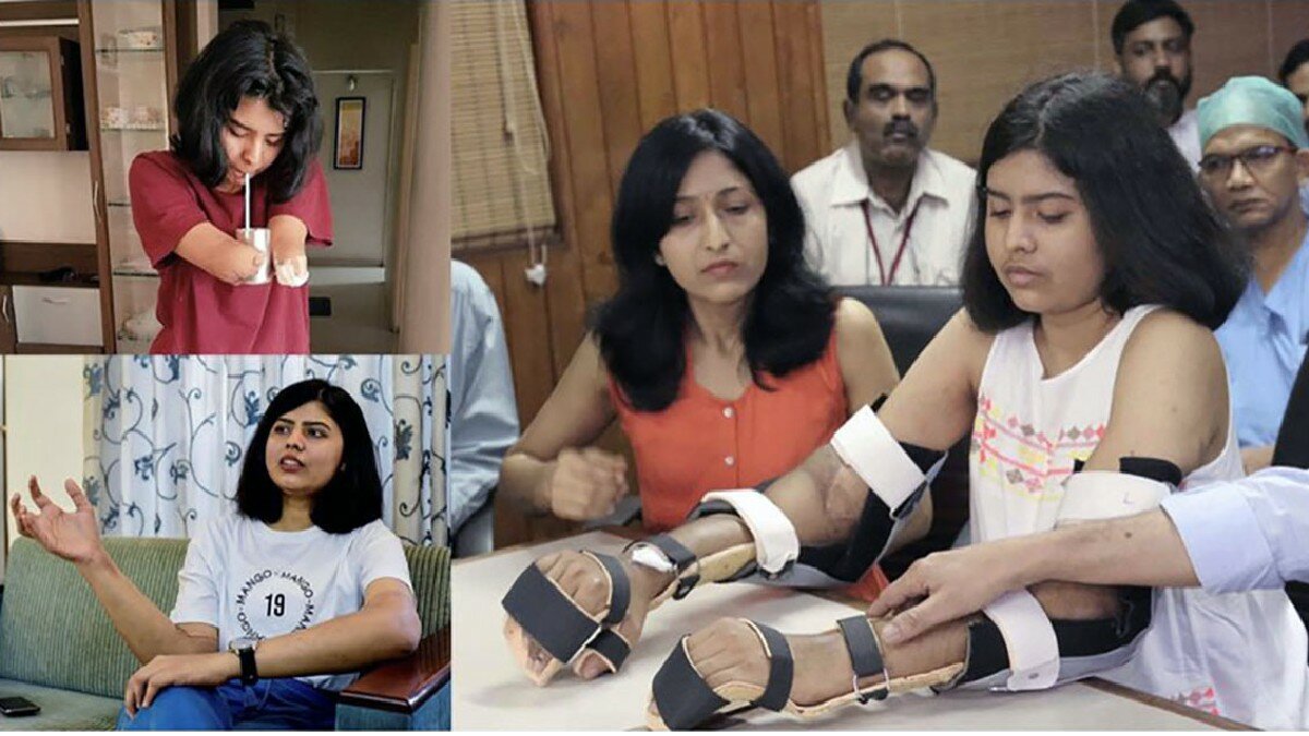 Sorprende mujer a la ciencia con transformación de sus brazos trasplantados